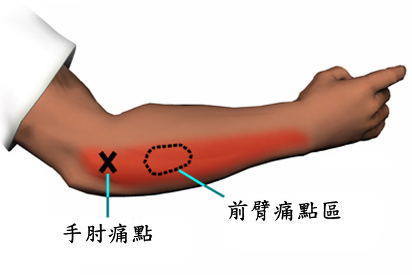 哪些症状属于射精障碍