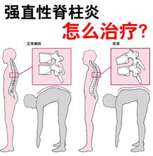 龟头炎怎么治疗好啊