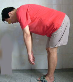 强直性脊椎炎的检查有哪几种
