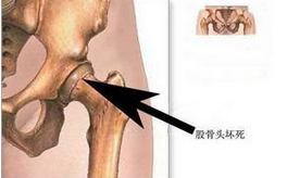 酒精、激素都是诱发男科的病因