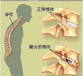 龟头炎与男科的区别
